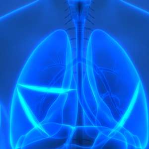 Lung scan image