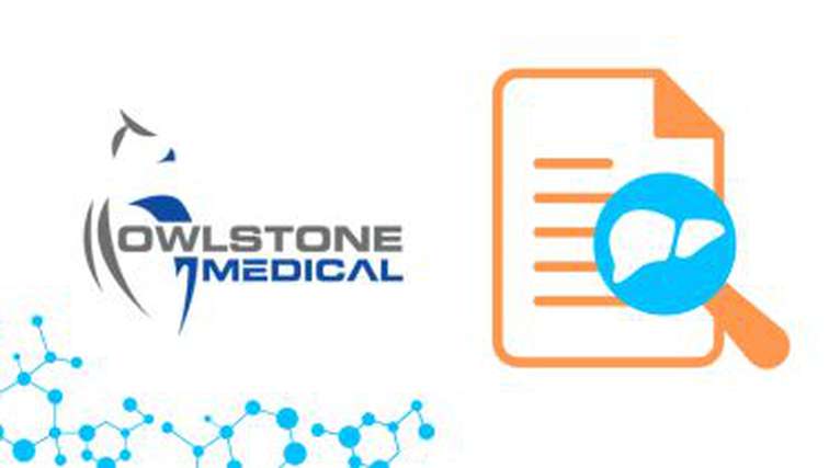 Owlstone Medical Publishes Liver Data