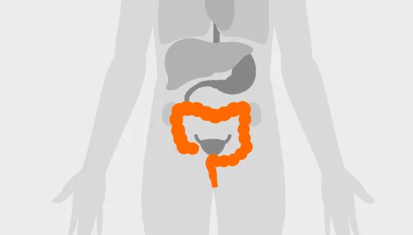 Identifying new breath biomarkers for colorectal cancer (2020)