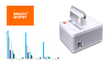 Casper and graph - Detected VOCs (ng) with ambient essential oils
