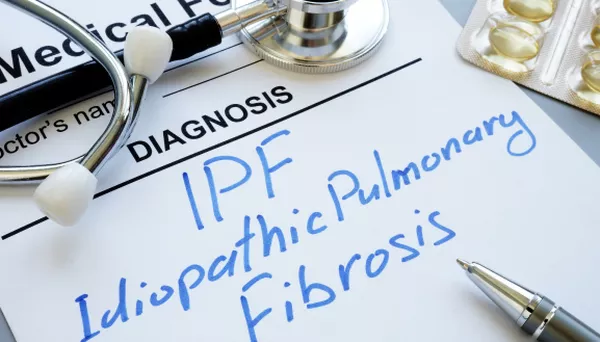 Using breath analysis to differentiate interstitial lung diseases