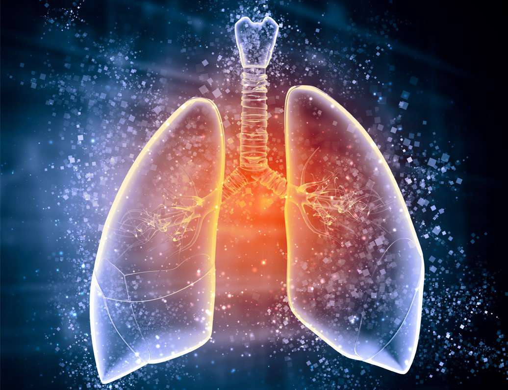 Lungs with illustrative inflammation