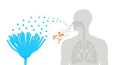 Breath Analysis: A Game-Changer in Early Invasive Aspergillosis Detection?