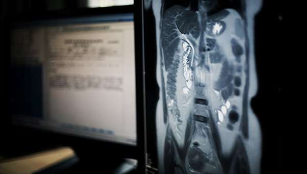 Hepatic Encephalopathy - Scan