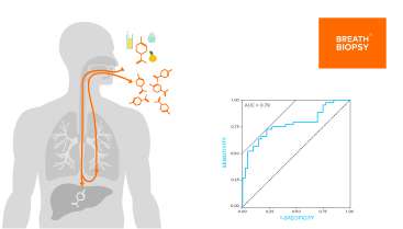 Advancing early detection for liver diseases including NAFLD and NASH with Breath Biopsy