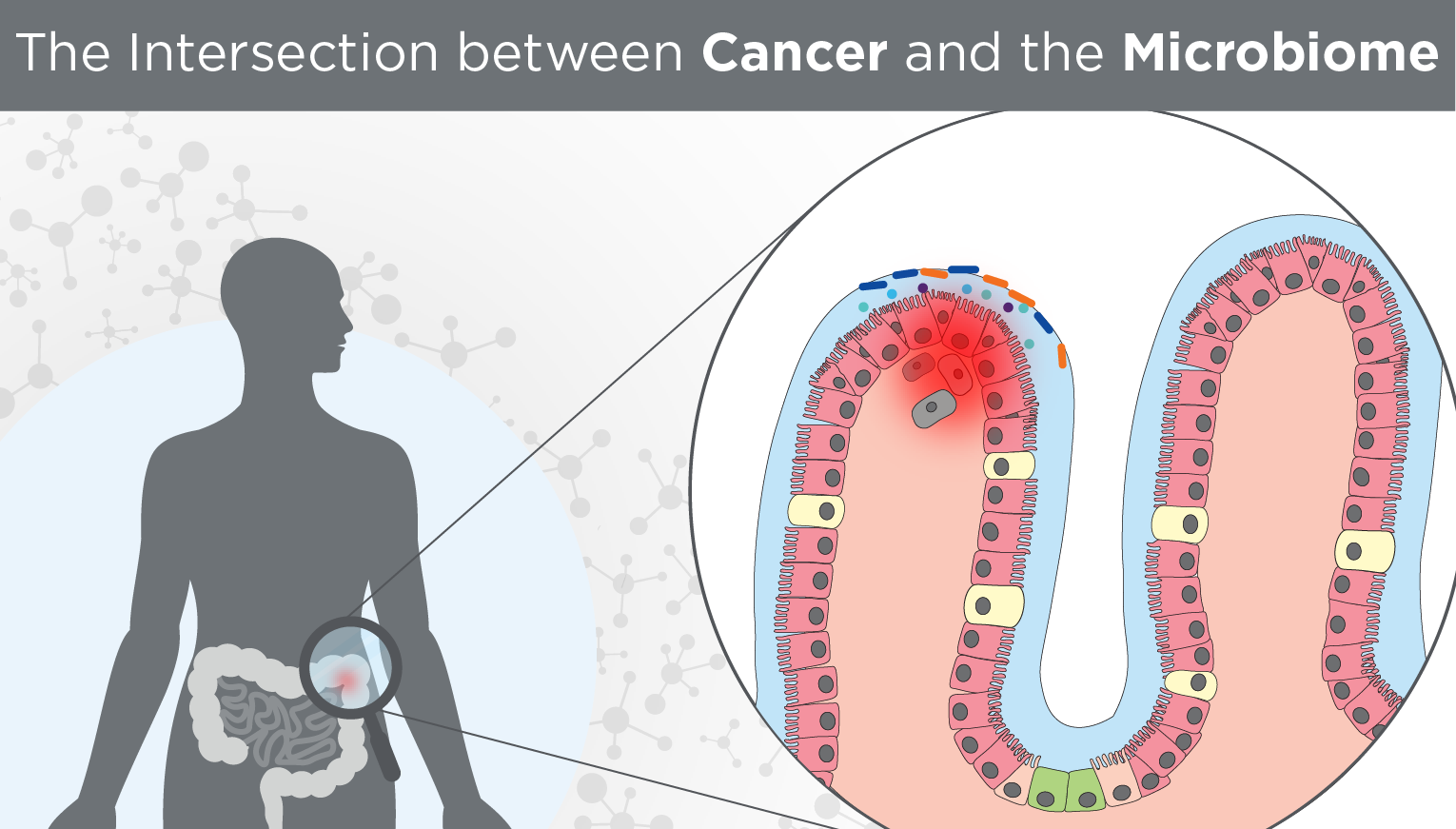 The Intersection between Cancer and the Microbiome