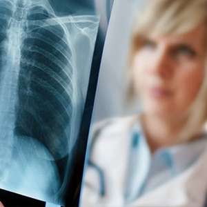 Doctor examining a lung scan