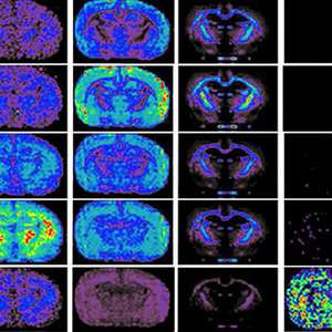 Mass spectrometry imaging