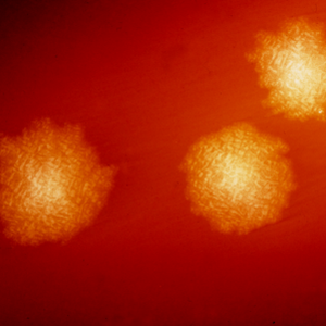 Clostridium difficile colonies after 48hrs growth on a blood agar plate; Magnified 4.8X. C. difficile, an anaerobic gram-positive rod, is the most frequently identified cause of antibiotic-associated