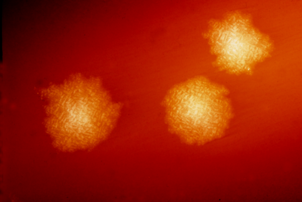 Clostridium difficile colonies after 48hrs growth on a blood agar plate; Magnified 4.8X. C. difficile, an anaerobic gram-positive rod, is the most frequently identified cause of antibiotic-associated 