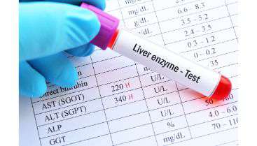 Liver Enzyme Test