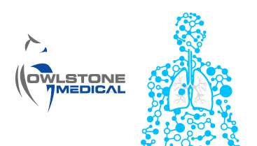 Owlstone Medical Presents Data Demonstrating Progress in Development of Breath Biopsy® Test for the Early Detection of Lung Cancer