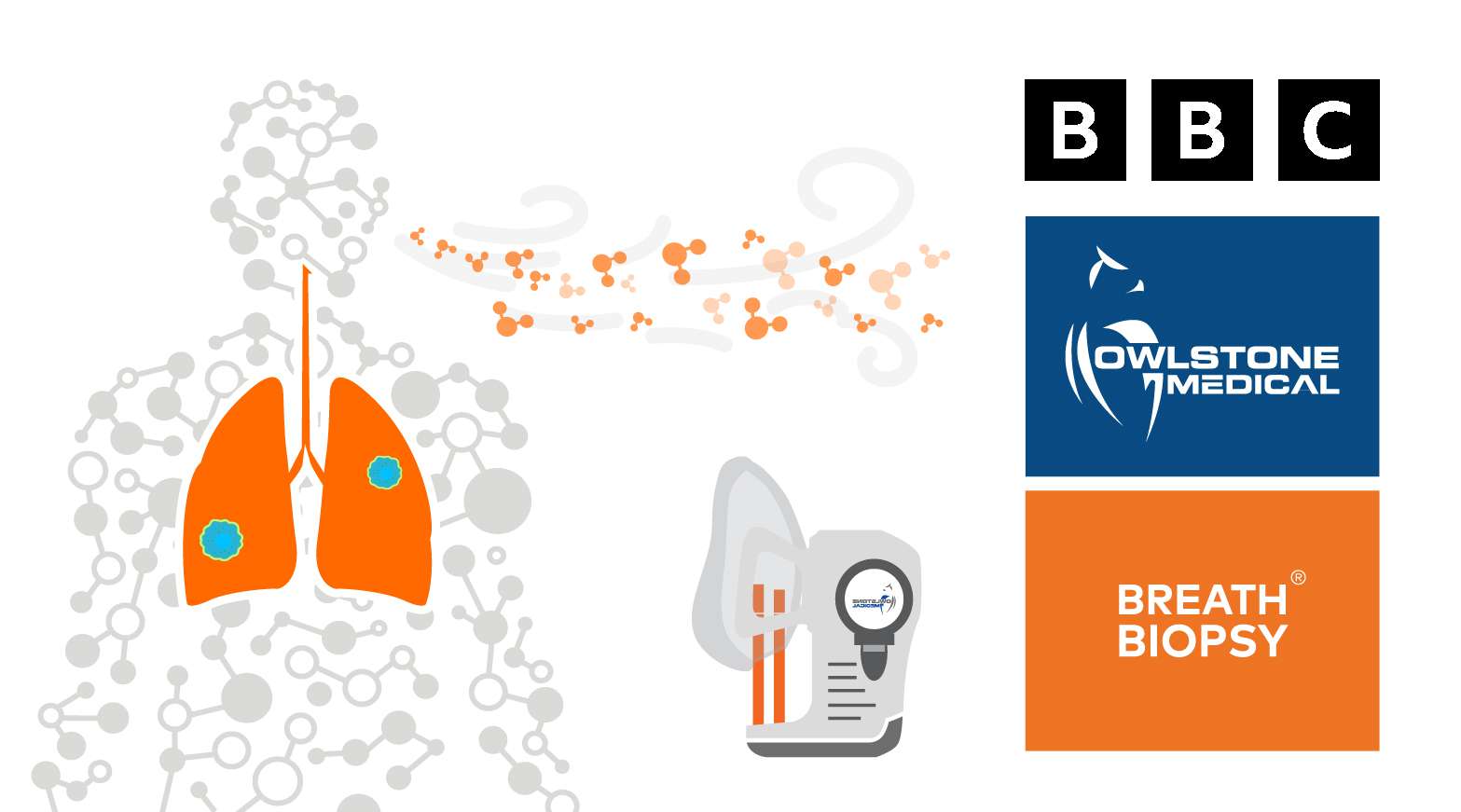 Blog snippet BBC piece Thumbnail