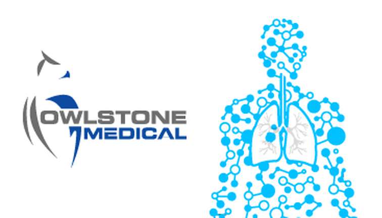 Owlstone Medical Presents Data Demonstrating Progress in Development of Breath Biopsy® Test for the Early Detection of Lung Cancer