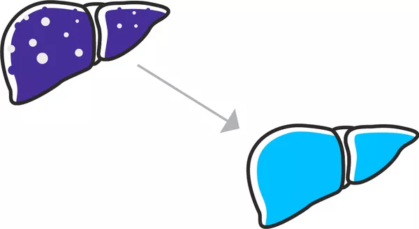 Diagnostic Potential of Breath VOCs for Liver Diseases