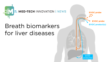 Med-Tech Innovation News – Biomarkers For Liver Disease