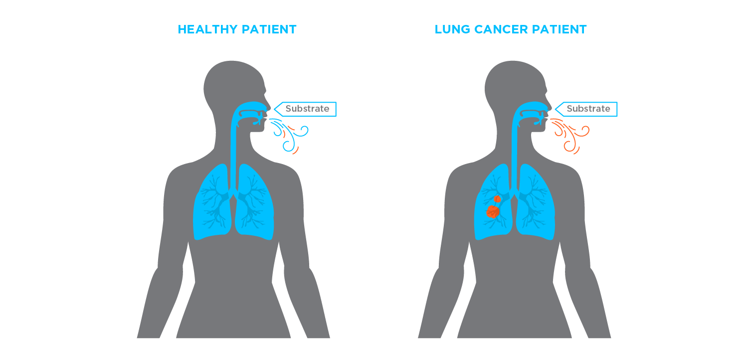 EVOC Probe for Lung Cancer
