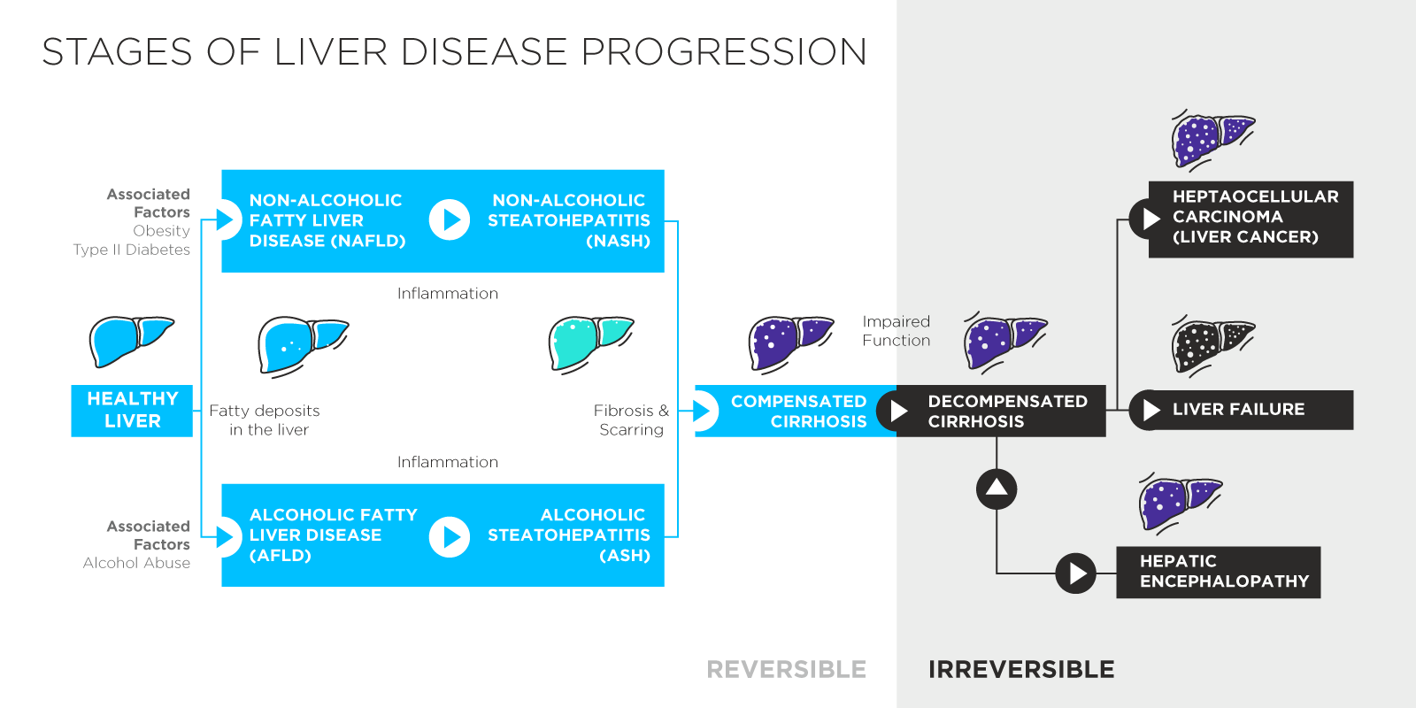 Liver Disease Schematic