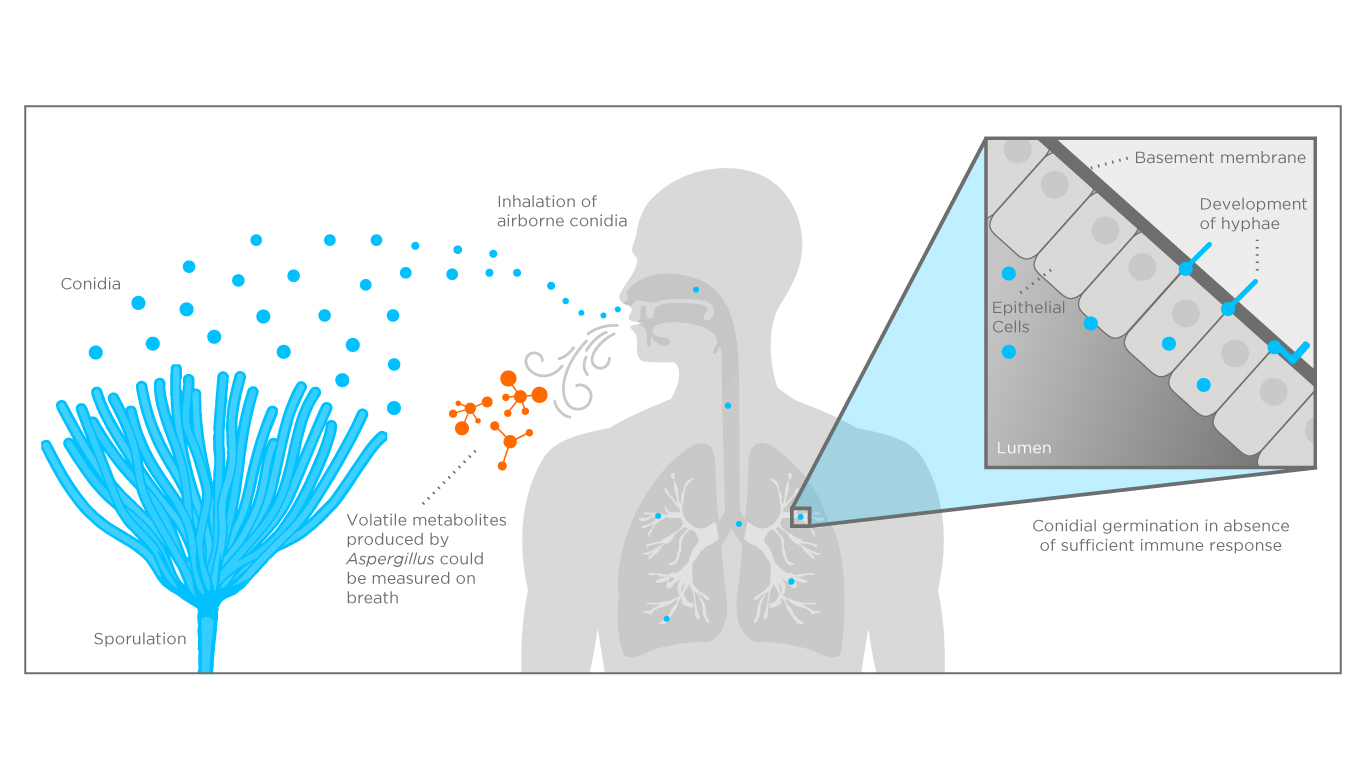 pathogenesis of aspergillosis