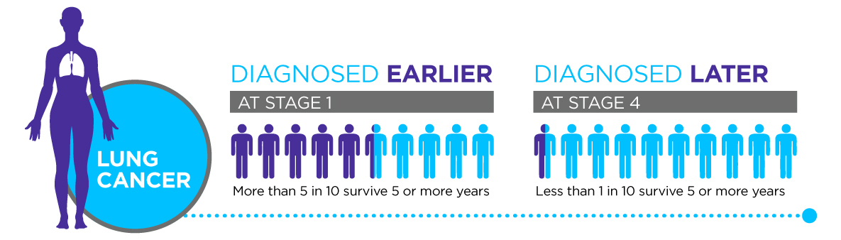 Lung cancer survival rates