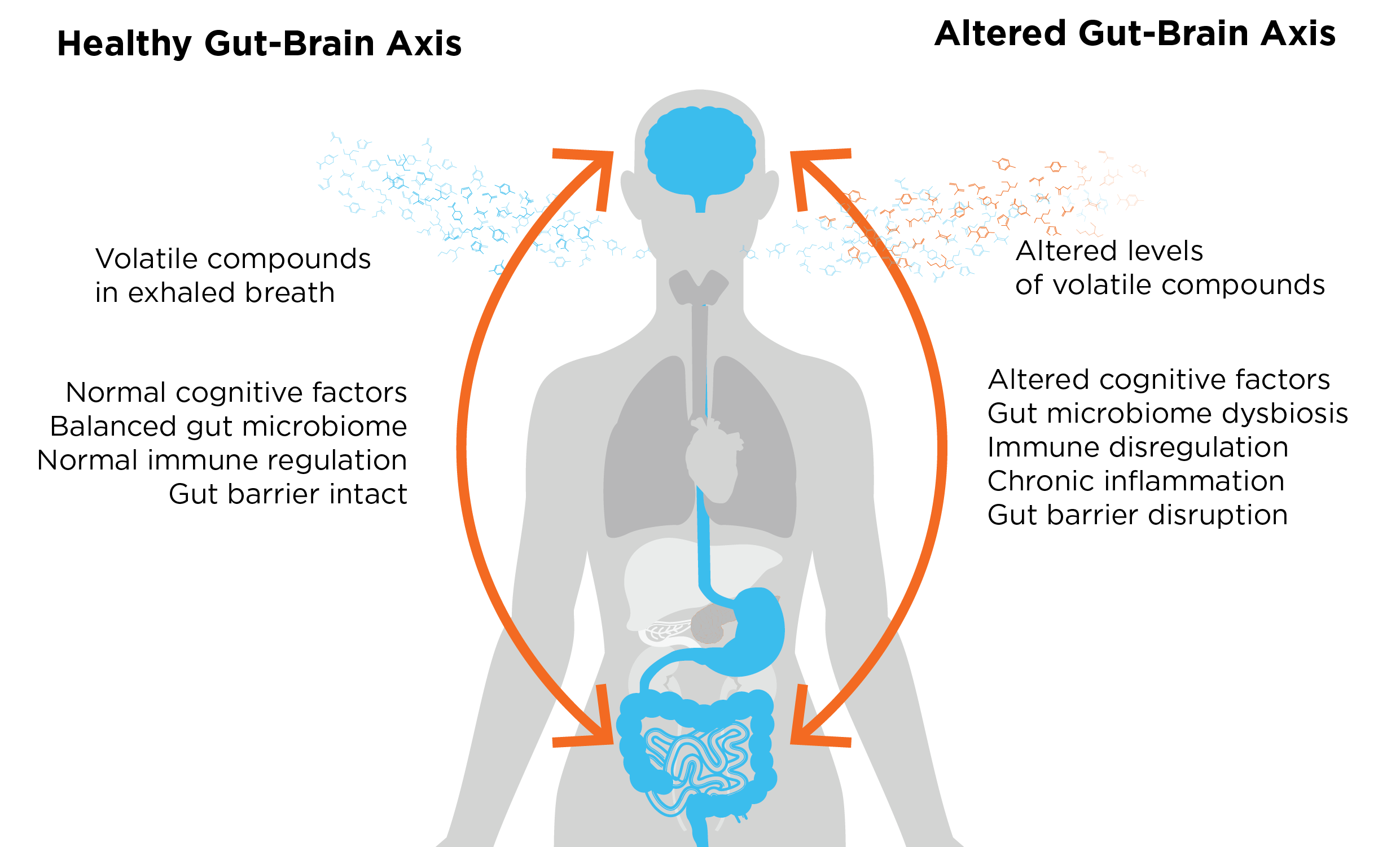Gut-brain axis figure 1