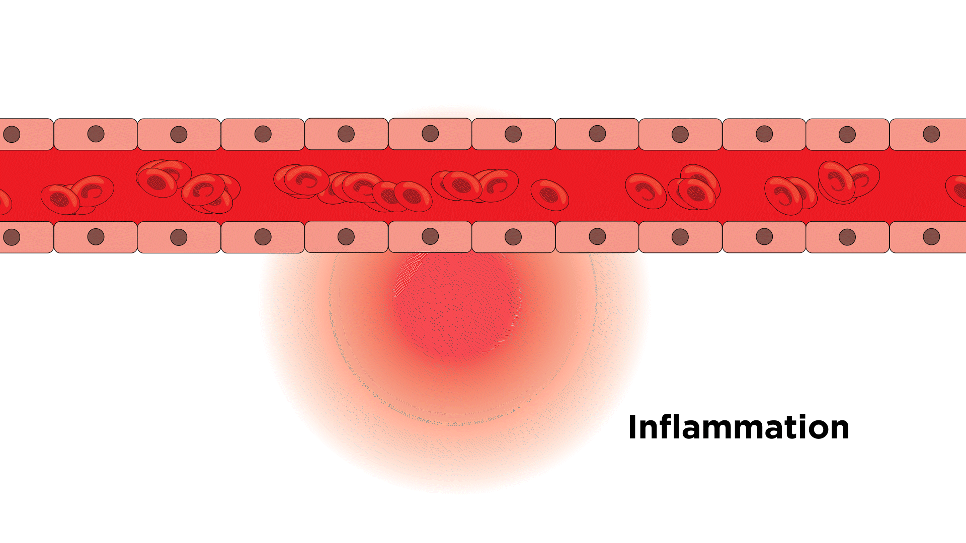 Inflammation to blood gif