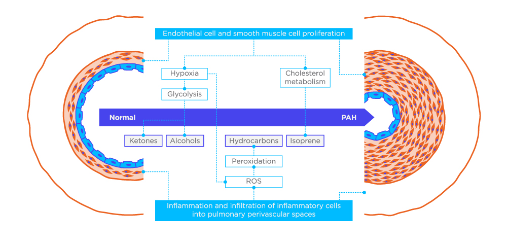PAH Case Study - Hypothetical schema of possible VOC sources in PAH