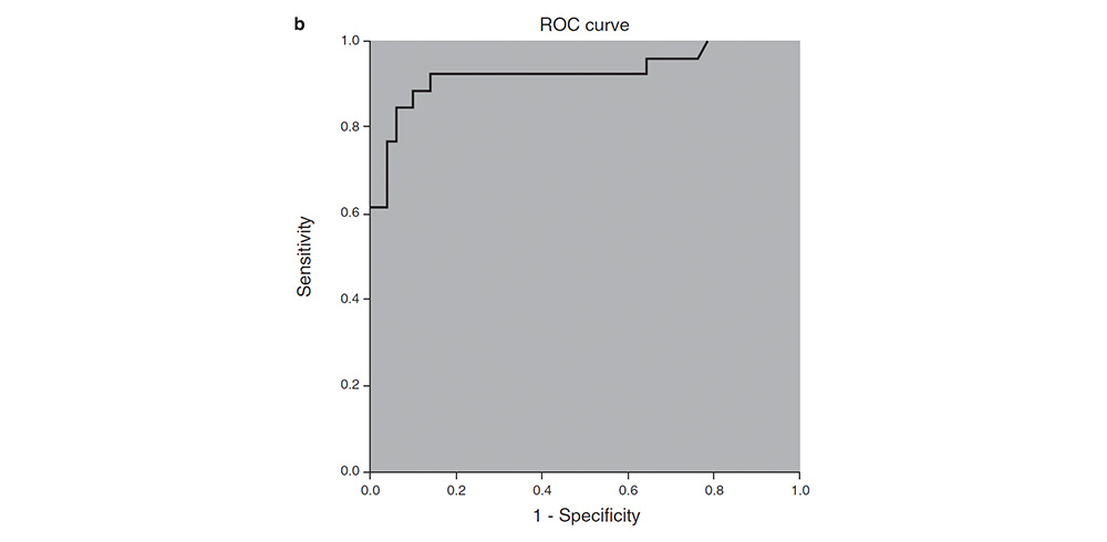 The receiver operating characteristic (ROC) curve for negative and positive samples. The receiver operating characteristic (ROC) curve for negative and positive samples.