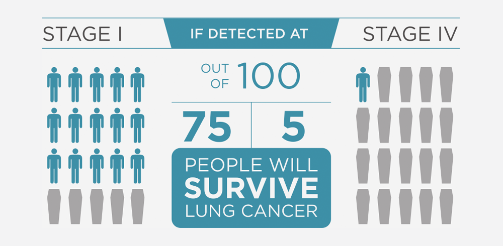 Early detection of lung cancer improves survival rates