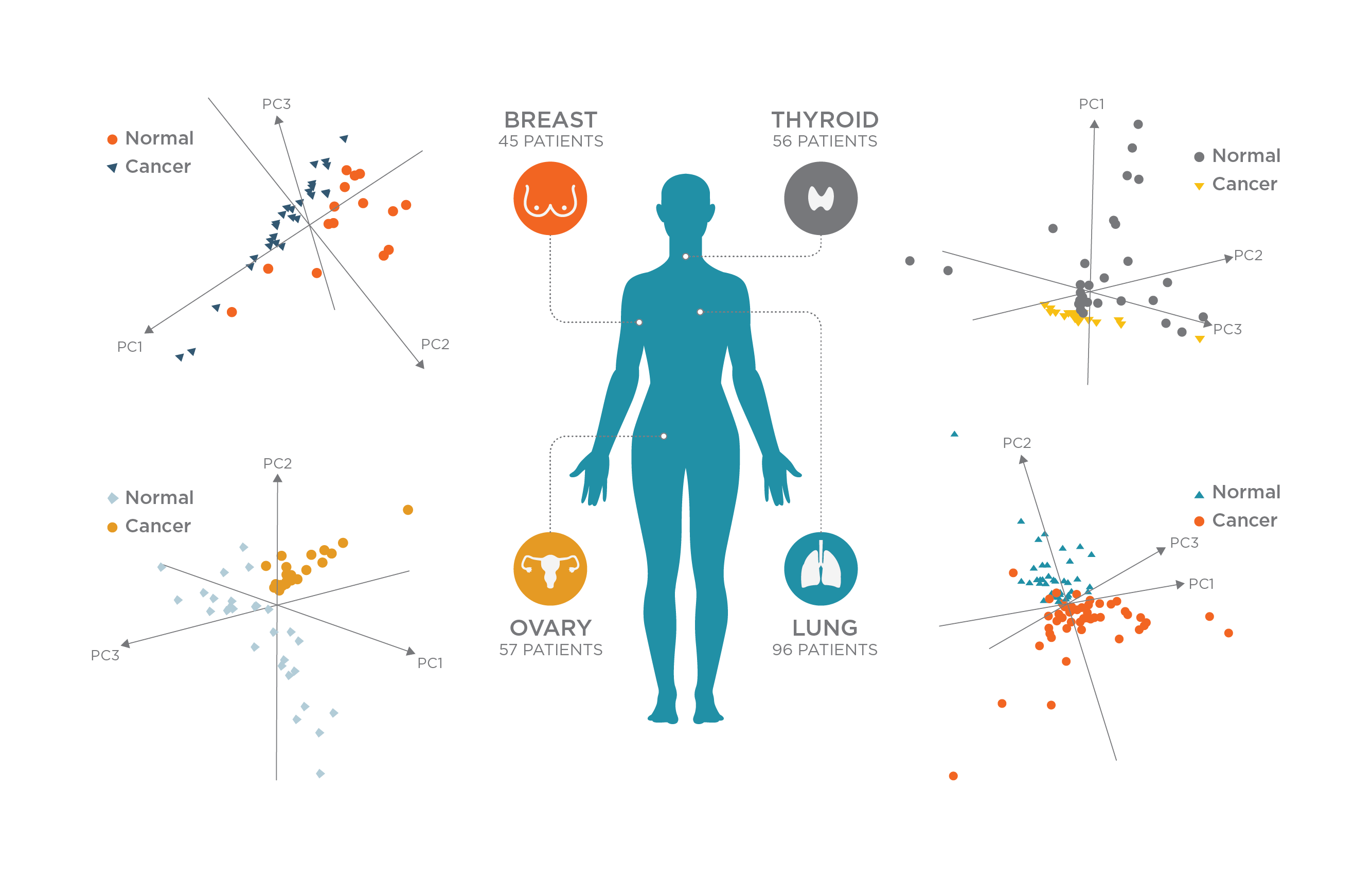 Mass spec pen cancer detection