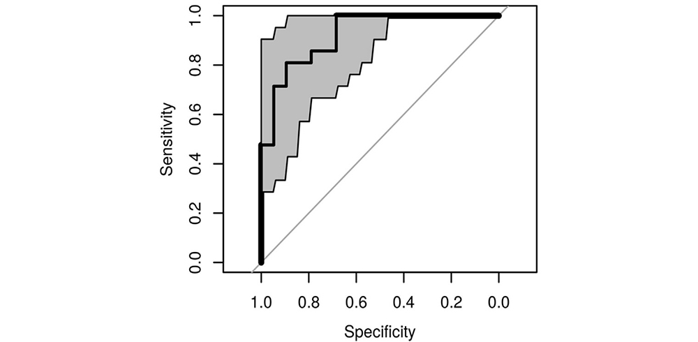 Receiver Operator Curve for breath analysis of patients with TB. Receiver Operator Curve for breath analysis of patients with TB.