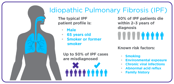 IPF infographic