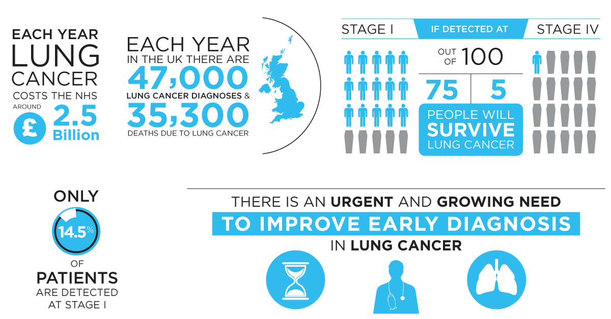 Lung Cancer Platform Now Available, DetectedX