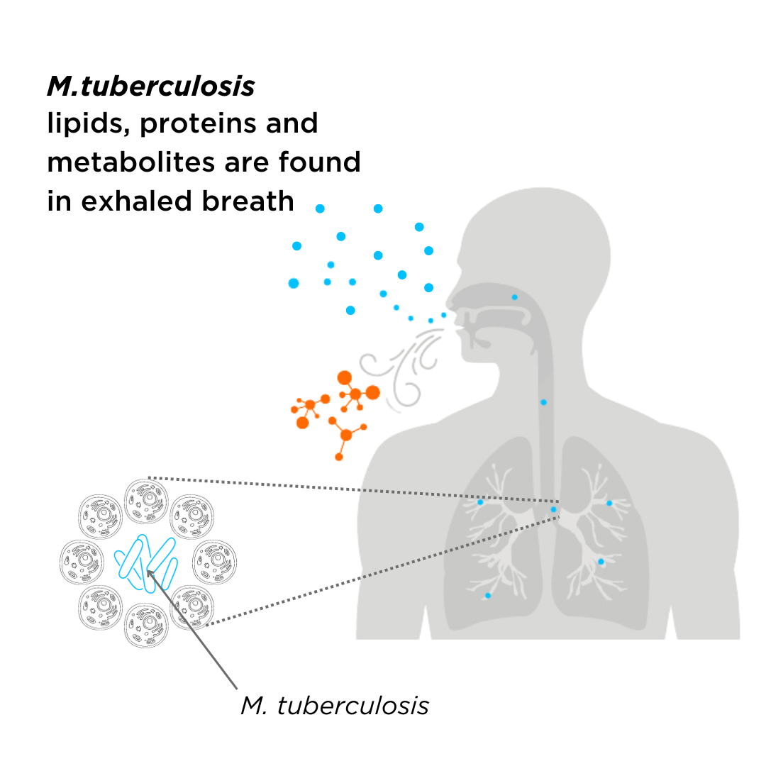 Tuberculosis