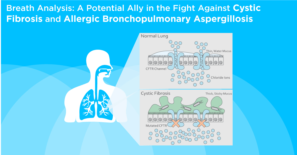 Breath Analysis: A Potential Ally in the Fight Against Cystic Fibrosis and Allergic Bronchopulmonary Aspergillosis