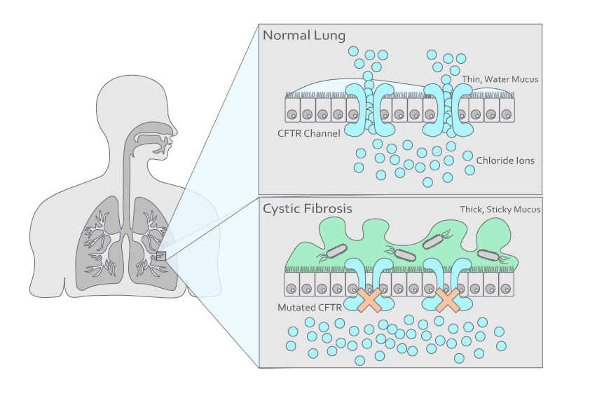 breath voc biomarkers