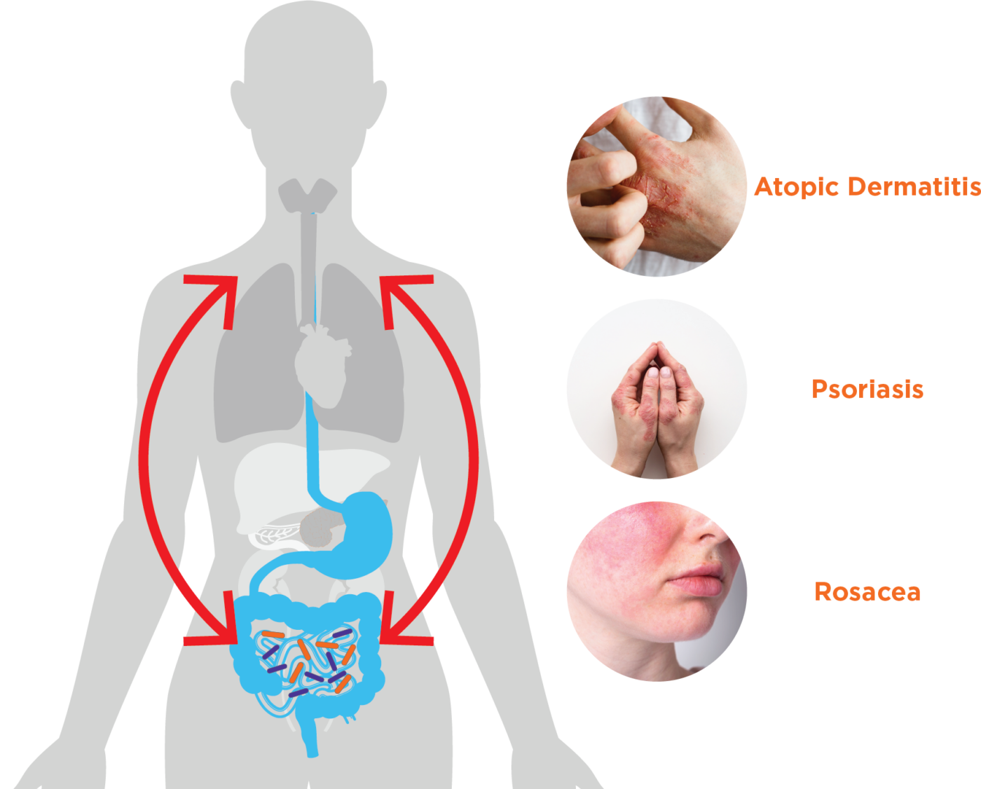 How the Gut Microbiome Influences Skin Health: Exploring the Gut-Skin Axis