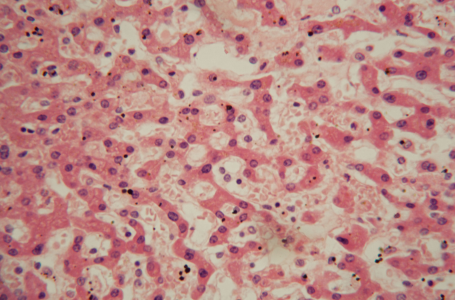 ferroptotic thumbnail