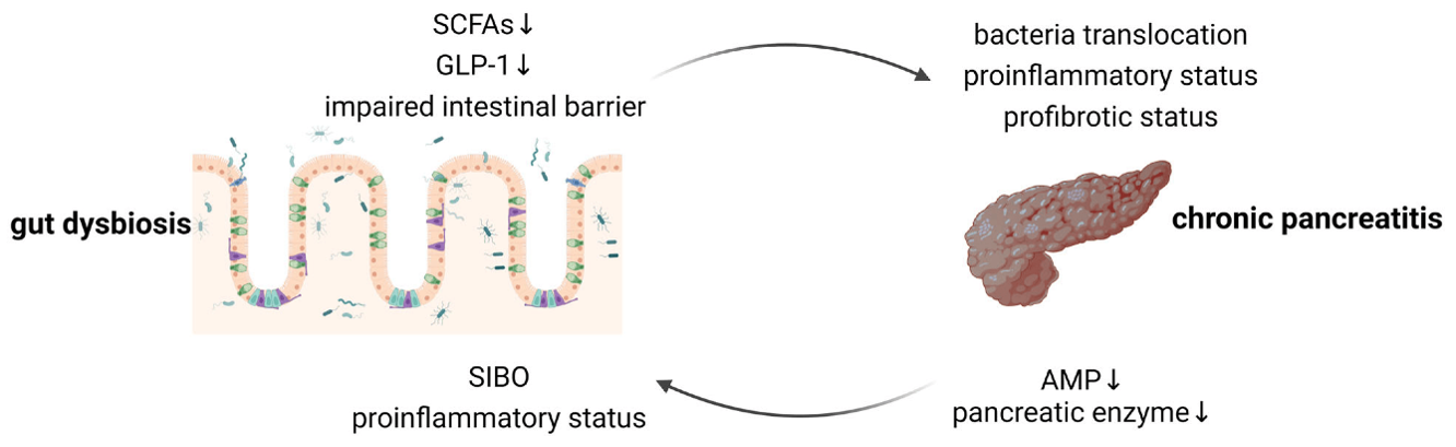 The link between the gut microbiome and pancreatitis
