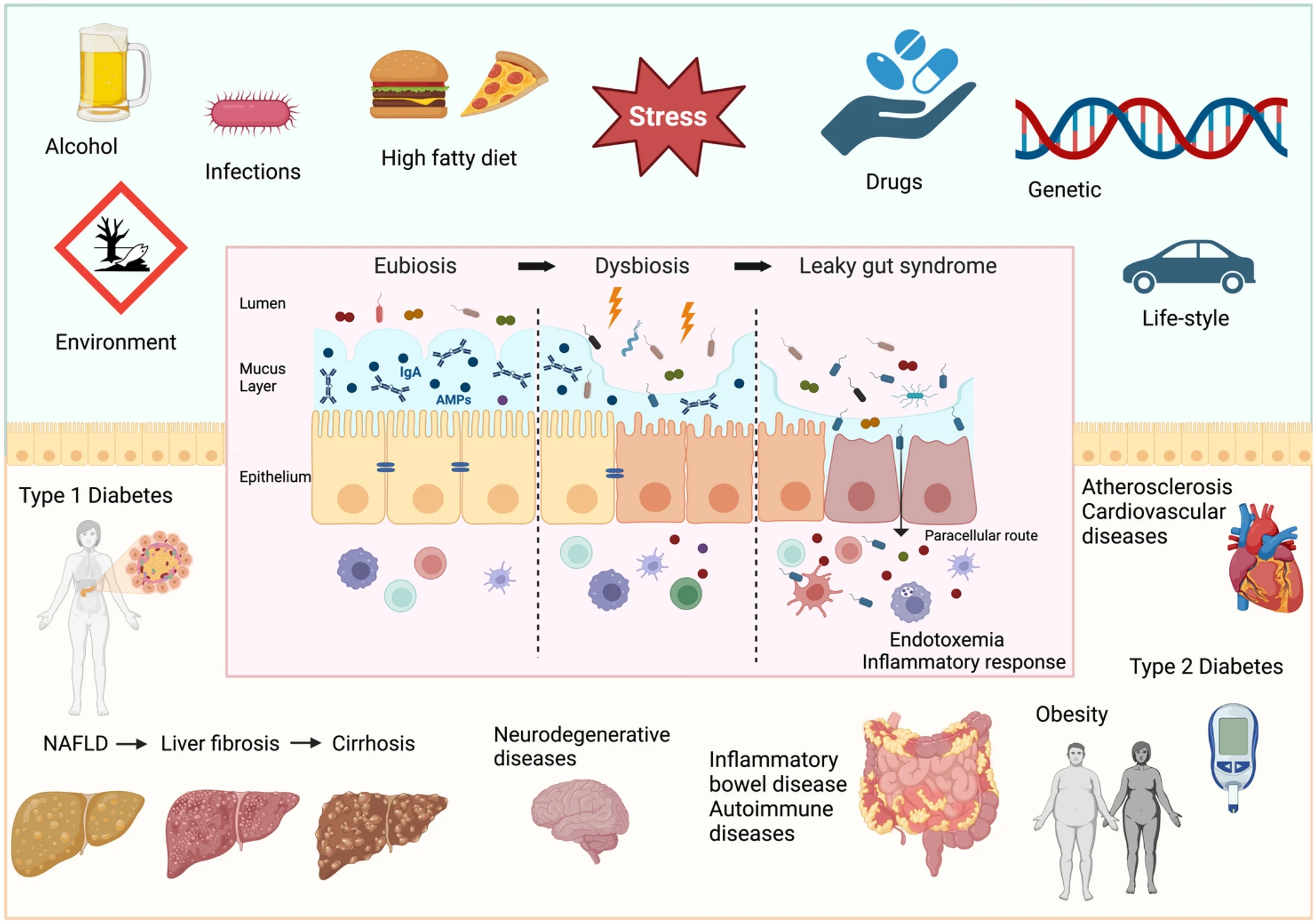 Factors determining intestinal barrier impairment and consequent systemic diseases