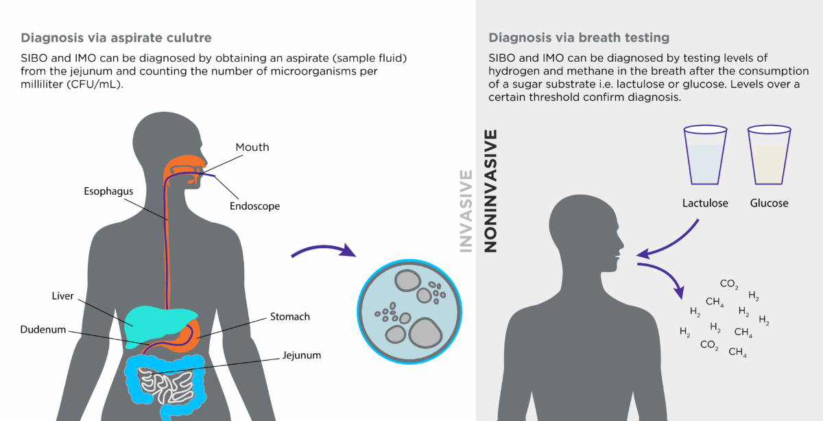 Breath Testing How Hydrogen-Methane Breath Tests Can Help Us Characterize Gut ...