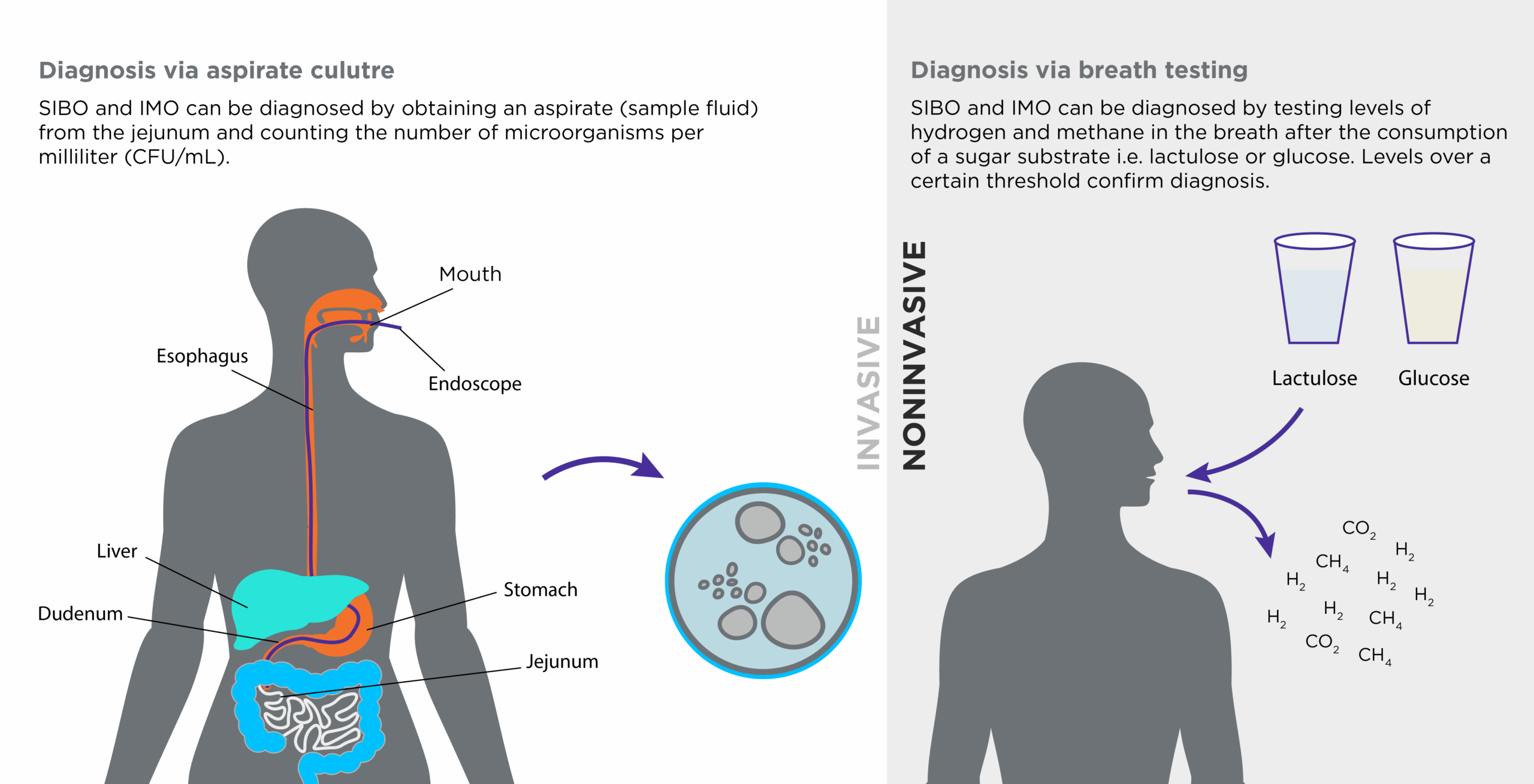 Invasive vs non-invasive SIBO testing