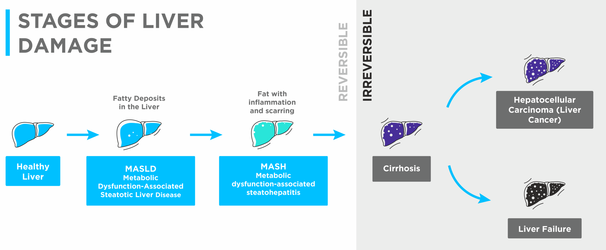 stages of liver damage